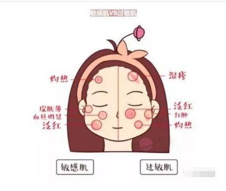 不同膚質(zhì)應該如何正確護膚？