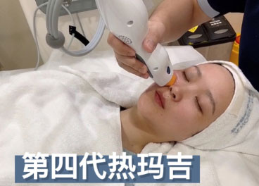 熱瑪吉的效果可以維持多久？熱瑪吉的效果可以保持一年嗎？