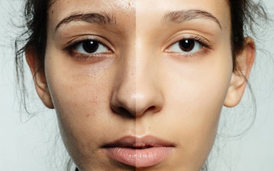 皮膚暗沉的原因有哪些？