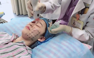 熱瑪吉有什么效果和副作用？